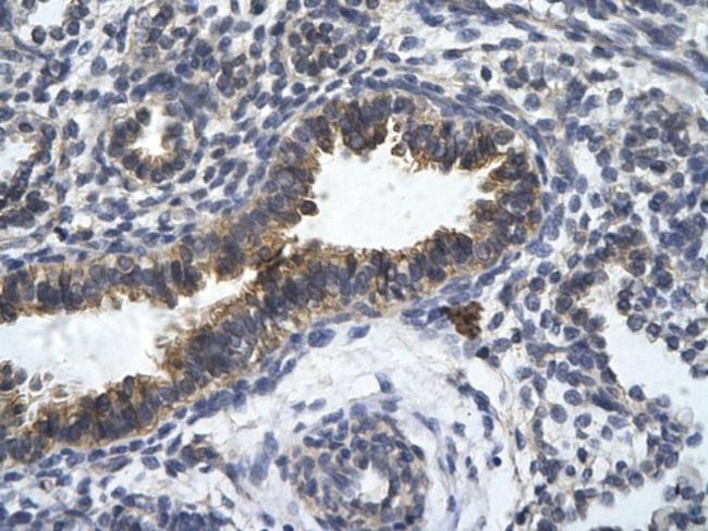 ZFR Antibody in Immunohistochemistry (Paraffin) (IHC (P))