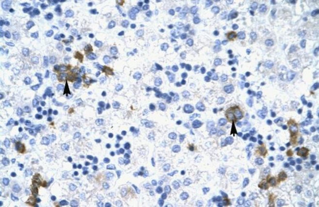 TRIM17 Antibody in Immunohistochemistry (IHC)
