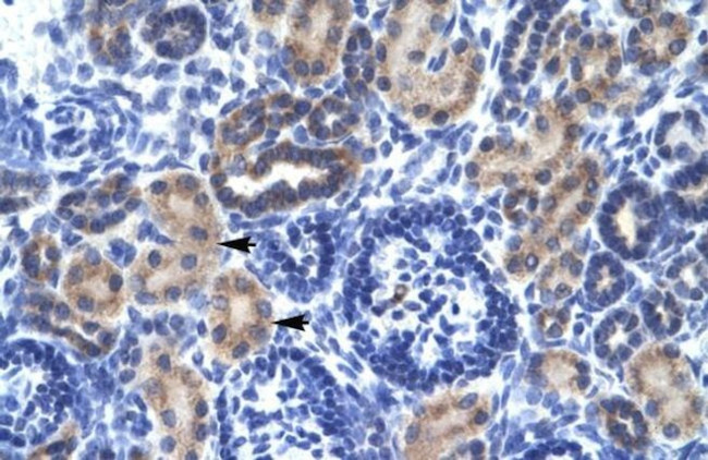 RNF141 Antibody in Immunohistochemistry (IHC)