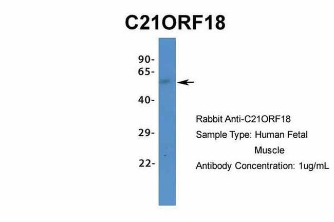 SETD4 Antibody in Western Blot (WB)