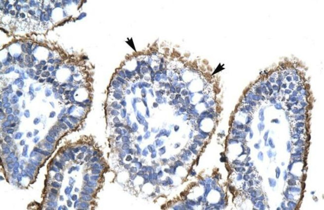 ZNHIT6 Antibody in Immunohistochemistry (IHC)