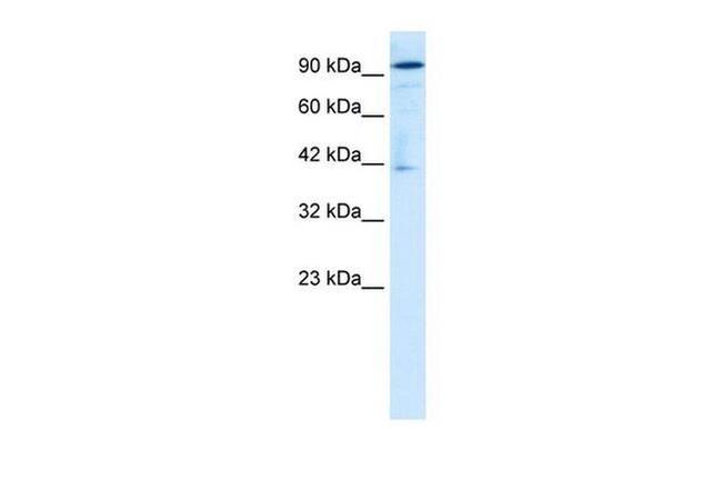 OTUD7B Antibody in Western Blot (WB)