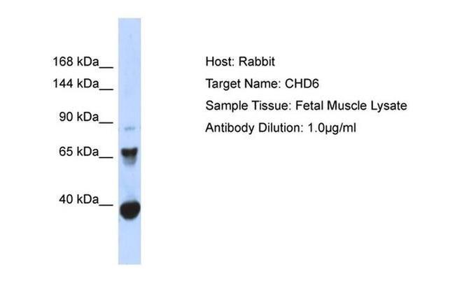 CHD6 Antibody in Western Blot (WB)