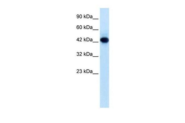 RNF135 Antibody in Western Blot (WB)