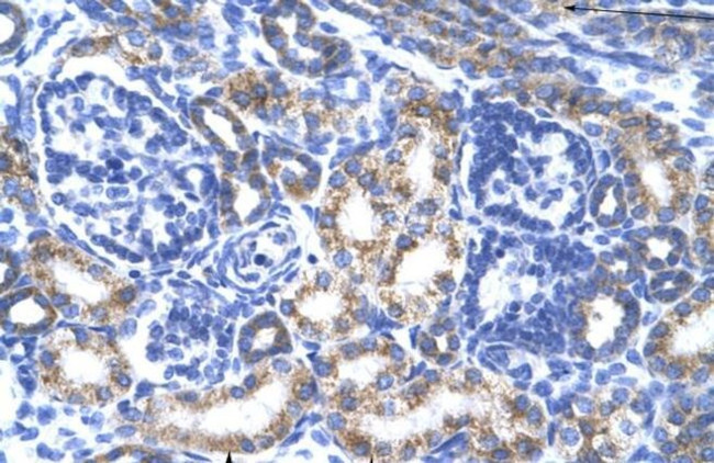 CREB3L2 Antibody in Immunohistochemistry (IHC)