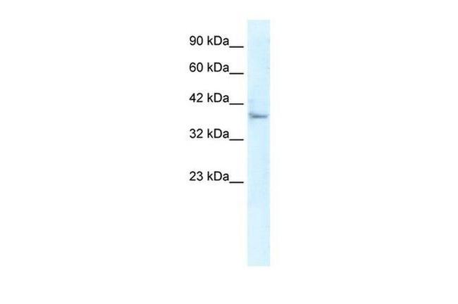 KLHL14 Antibody in Western Blot (WB)