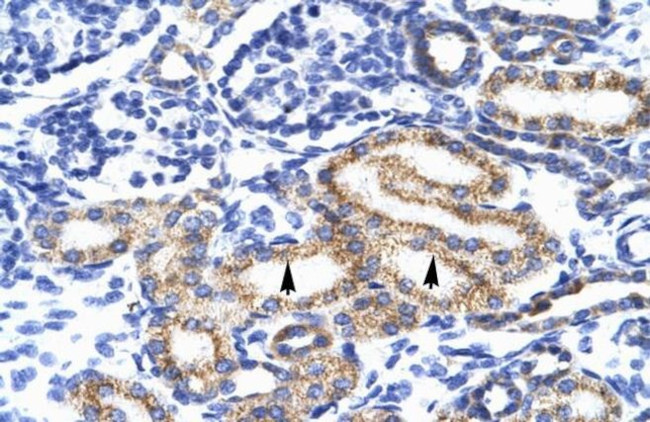 MEIS2 Antibody in Immunohistochemistry (IHC)