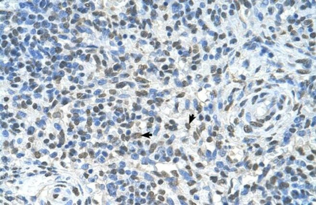 ZMYND11 Antibody in Immunohistochemistry (IHC)
