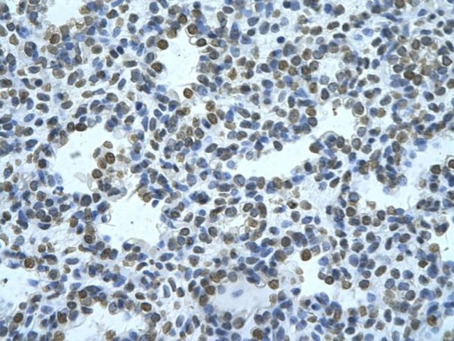 ZMYND11 Antibody in Immunohistochemistry (Paraffin) (IHC (P))