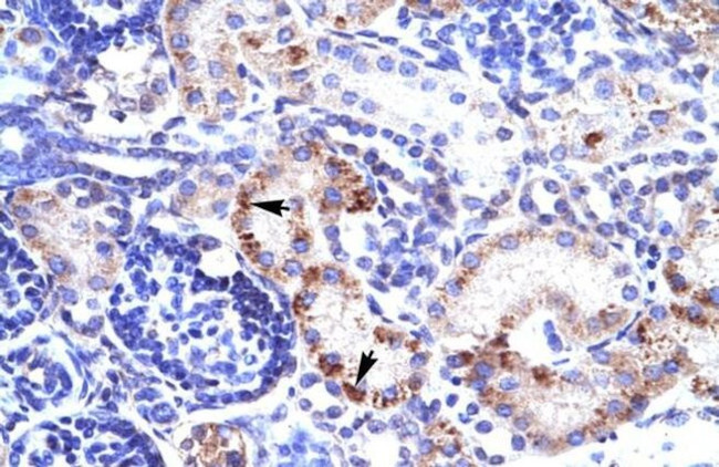 RIM3 Antibody in Immunohistochemistry (IHC)