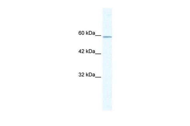 KLHL5 Antibody in Western Blot (WB)