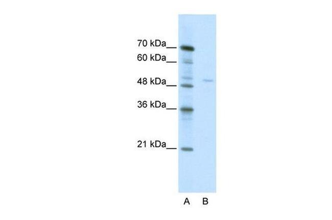 TRIM38 Antibody in Western Blot (WB)