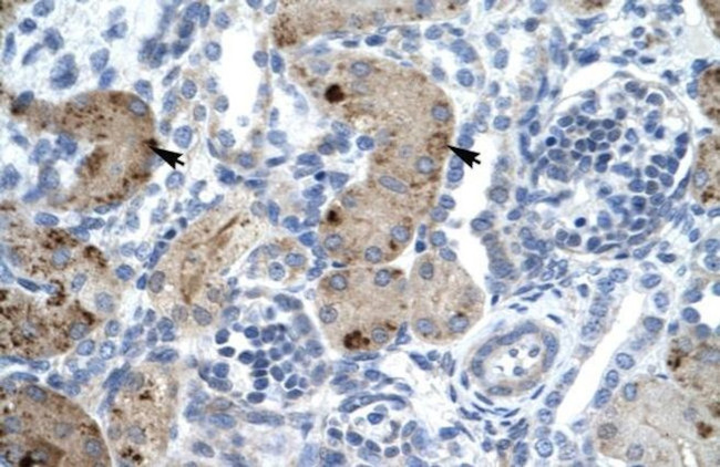 ZNF258 Antibody in Immunohistochemistry (IHC)