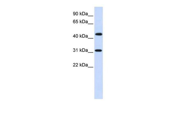 ZNF684 Antibody in Western Blot (WB)
