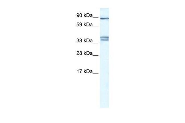 CLCNKB Antibody in Western Blot (WB)
