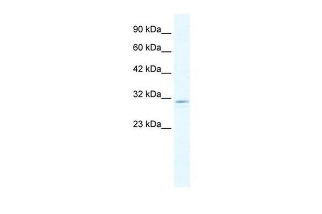 CLIC2 Antibody in Western Blot (WB)