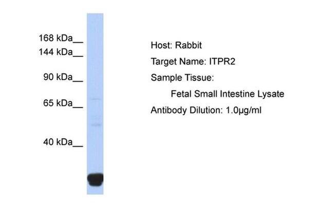 IP3 Receptor 2 Antibody in Western Blot (WB)