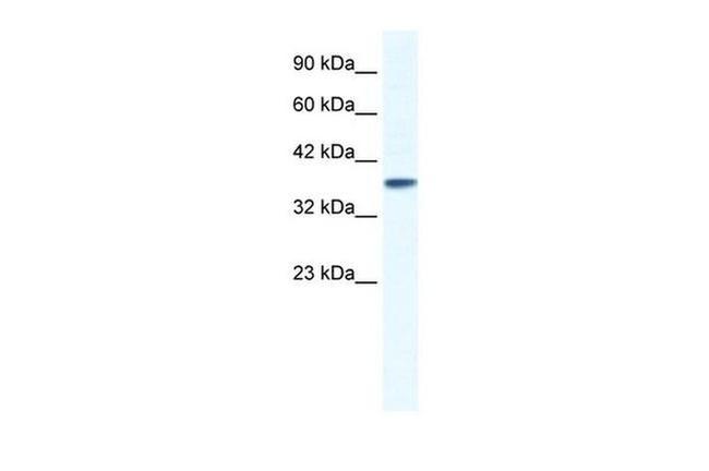 KCNK3 Antibody in Western Blot (WB)
