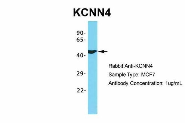 KCNN4 Antibody in Western Blot (WB)