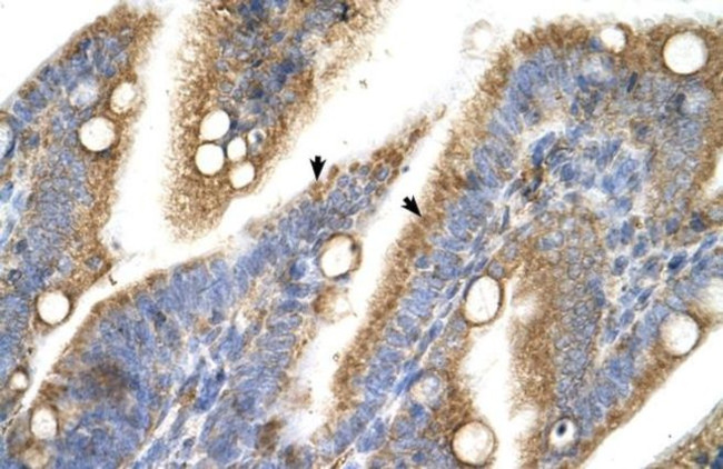 TRPM5 Antibody in Immunohistochemistry (IHC)