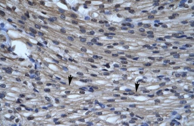 CLIC5 Antibody in Immunohistochemistry (IHC)