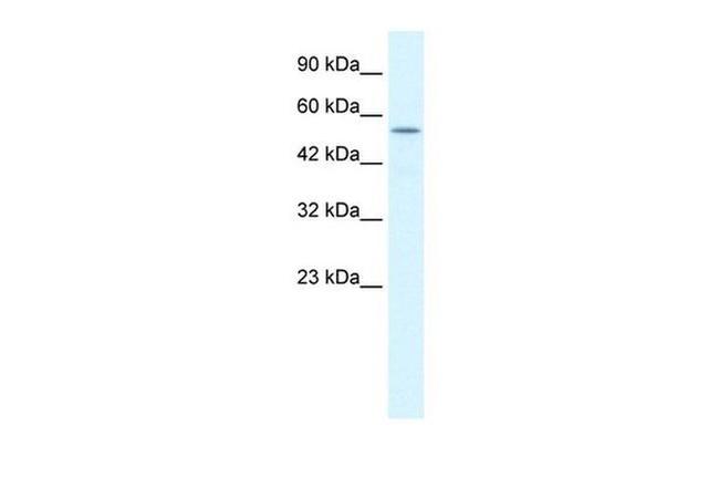 KCNK10 Antibody in Western Blot (WB)
