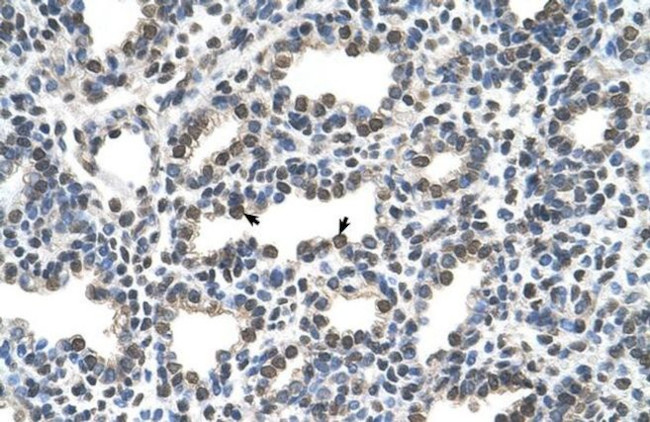 KCTD6 Antibody in Immunohistochemistry (IHC)