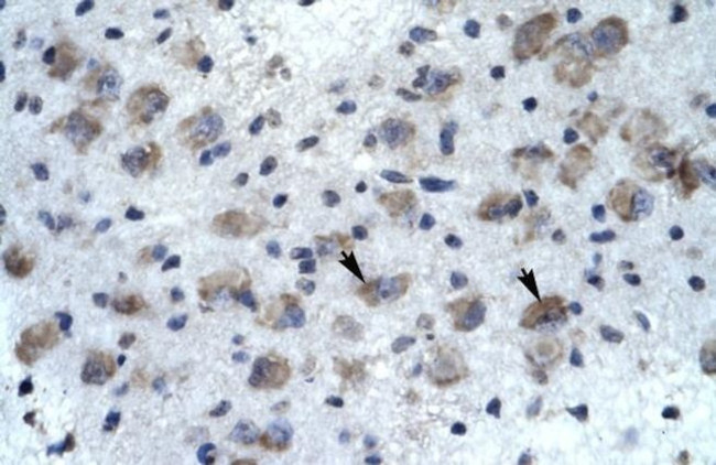 KCNH5 Antibody in Immunohistochemistry (IHC)