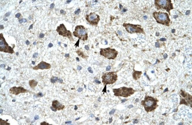 KChIP2 Antibody in Immunohistochemistry (IHC)