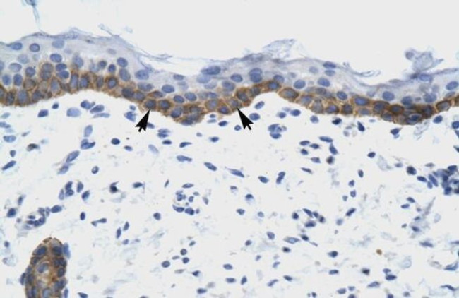 NUDT9 Antibody in Immunohistochemistry (IHC)