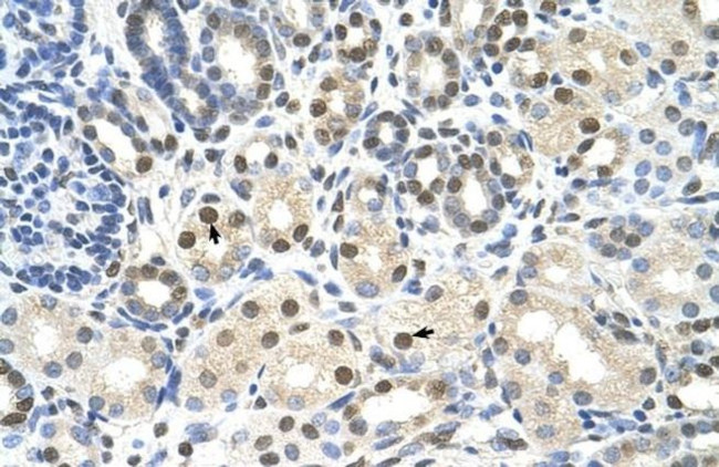 CACNB1 Antibody in Immunohistochemistry (IHC)