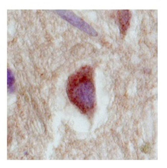 SLC18A1 Antibody in Immunohistochemistry (IHC)