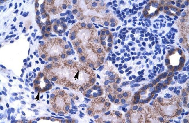 ZNF84 Antibody in Immunohistochemistry (IHC)