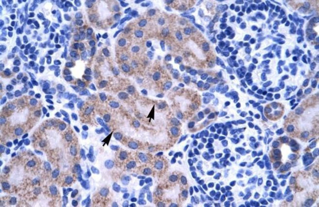 ZNF134 Antibody in Immunohistochemistry (IHC)