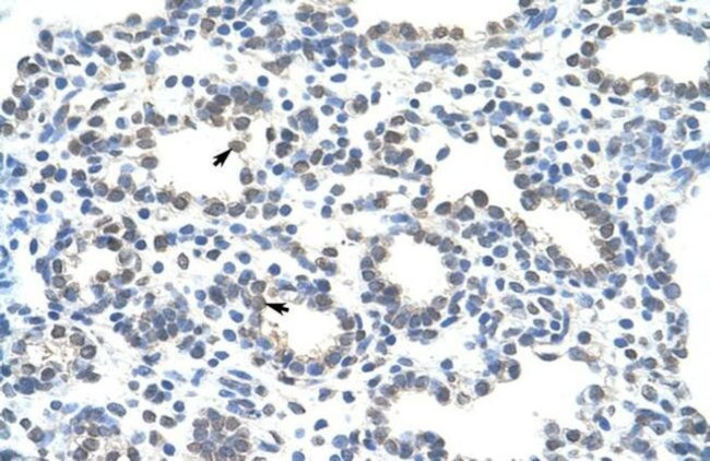 ZRANB2 Antibody in Immunohistochemistry (IHC)