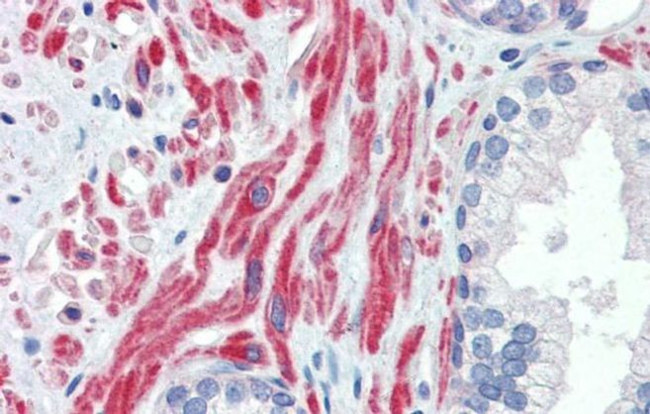 SSX4 Antibody in Immunohistochemistry (IHC)