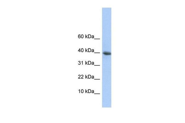POLR2I Antibody in Western Blot (WB)