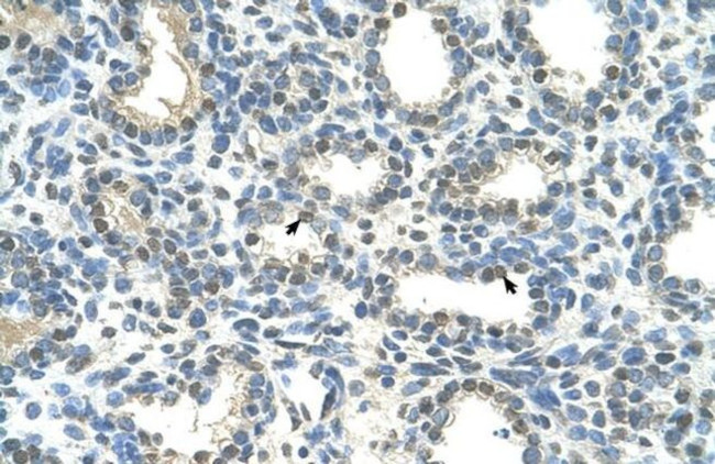 HOXC9 Antibody in Immunohistochemistry (IHC)