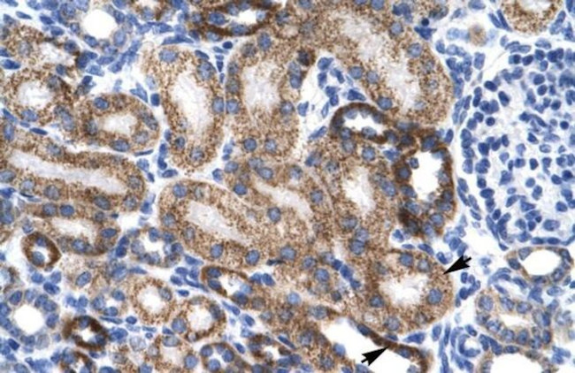 ZNF75D Antibody in Immunohistochemistry (IHC)