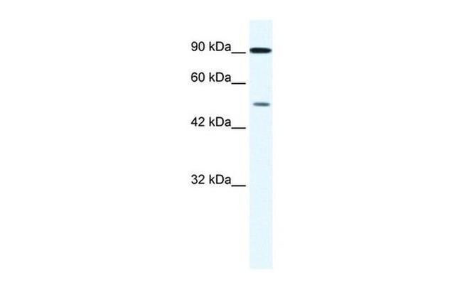 ZNF175 Antibody in Western Blot (WB)