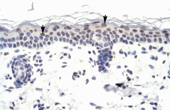 ZNF223 Antibody in Immunohistochemistry (IHC)
