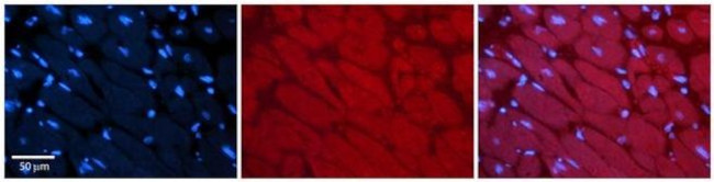 MLXIP Antibody in Immunohistochemistry (Paraffin) (IHC (P))