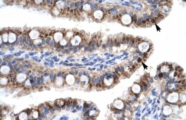 ZNF167 Antibody in Immunohistochemistry (IHC)