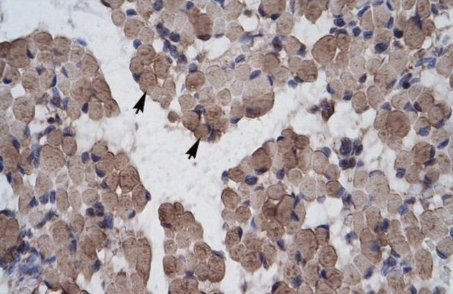 LHX9 Antibody in Immunohistochemistry (IHC)