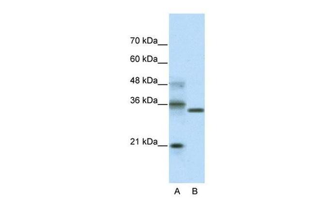 HES4 Antibody in Western Blot (WB)