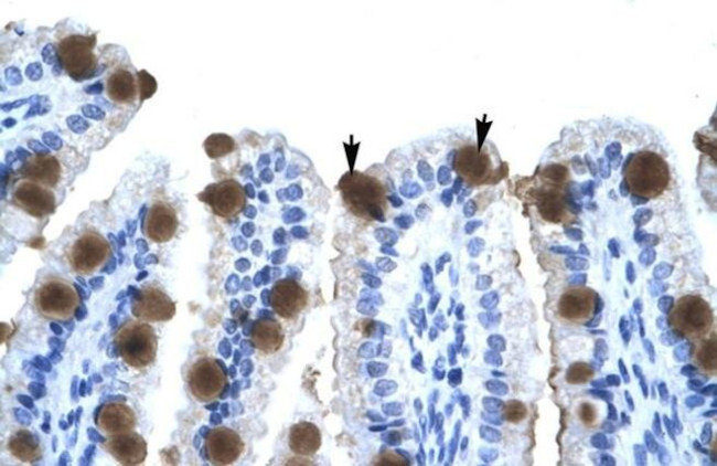ZNF70 Antibody in Immunohistochemistry (IHC)