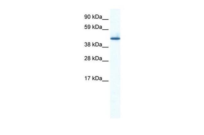 ZNF557 Antibody in Western Blot (WB)