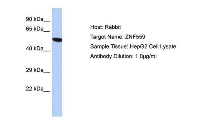 ZNF559 Antibody in Western Blot (WB)