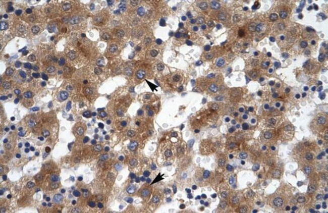 ZNF551 Antibody in Immunohistochemistry (IHC)