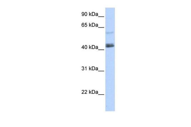 PRDM15 Antibody in Western Blot (WB)